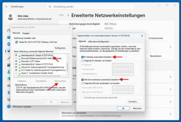 IPv4-Einstellungen in Windows mit automatischer IP-Adresse und DNS-Server